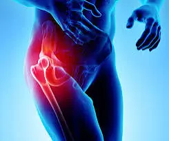 Hip Pain: Warning Signs That May Indicate Something More Serious