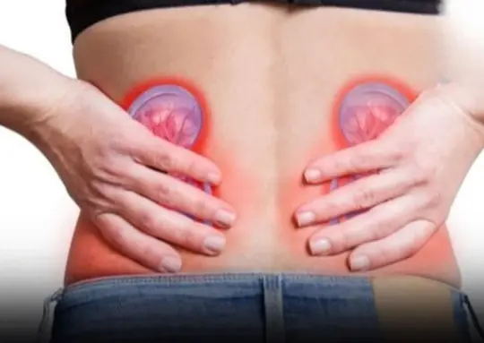 4 Simple Waters That Can Help Treat Kidney Stones Naturally