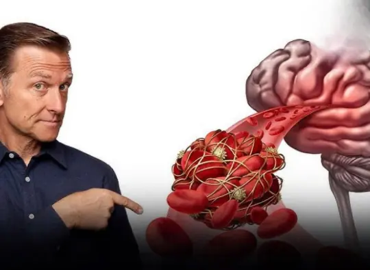 9 Silent Warning Signs of a Brain Blood Clot That Can Appear Weeks Before a Stroke