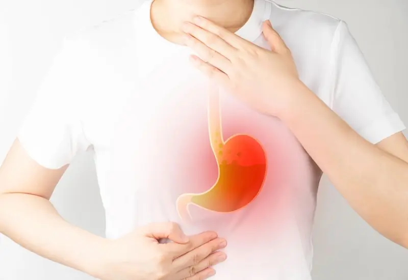 Looking for Natural Acid Reflux Relief? Start With These 3 Simple Habits
