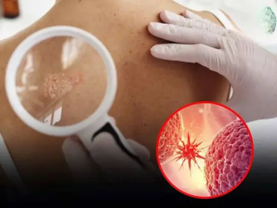 Don’t Ignore These 20 Early Warning Signs That Your Body Could Be Fighting Can:cer