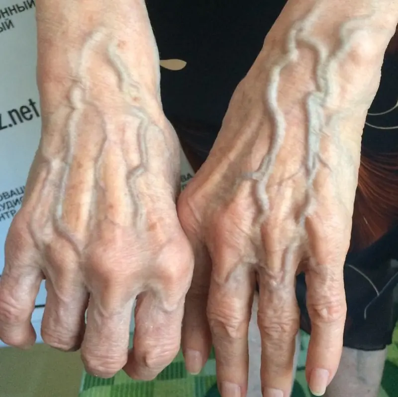 Your veins could be sending subtle clues about your body. Here's what they may mean