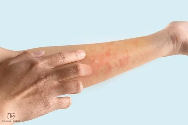 Liver Problems Can Show Up at Night - Here Are 4 Signs You Shouldn't Ignore