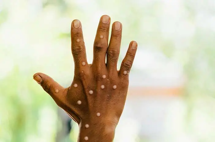 If You're Over 40, Watch for These 6 Signals Your Body May Be Sending