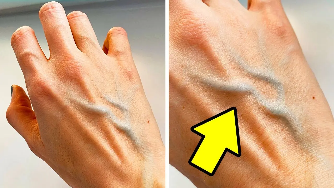 When Visible Veins Are Harmless—and When They Might Deserve Attention