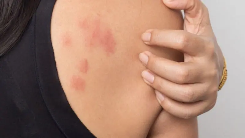 Persistent Itching in These 9 Areas Could Be Your Body's Warning Sign - Don't Ignore It