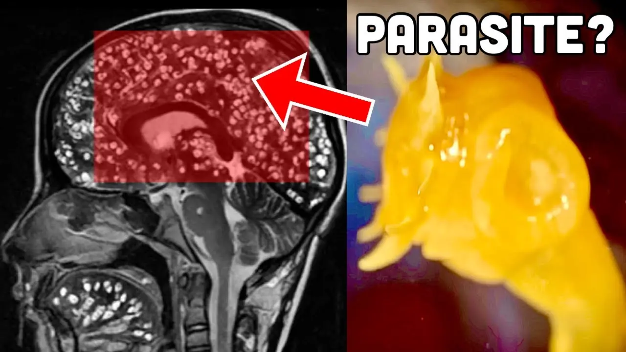 Many People Eat This Every Week—But Few Know About the Parasite Risk