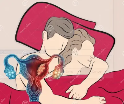 Husbands With These 2 Bad Habits May Put Their Wives at Higher Risk of Br:east Can:cer