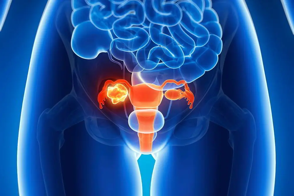 Your Body May Be Sending These 8 Important Signals - Know the Possible Signs of Ovarian Can.cer