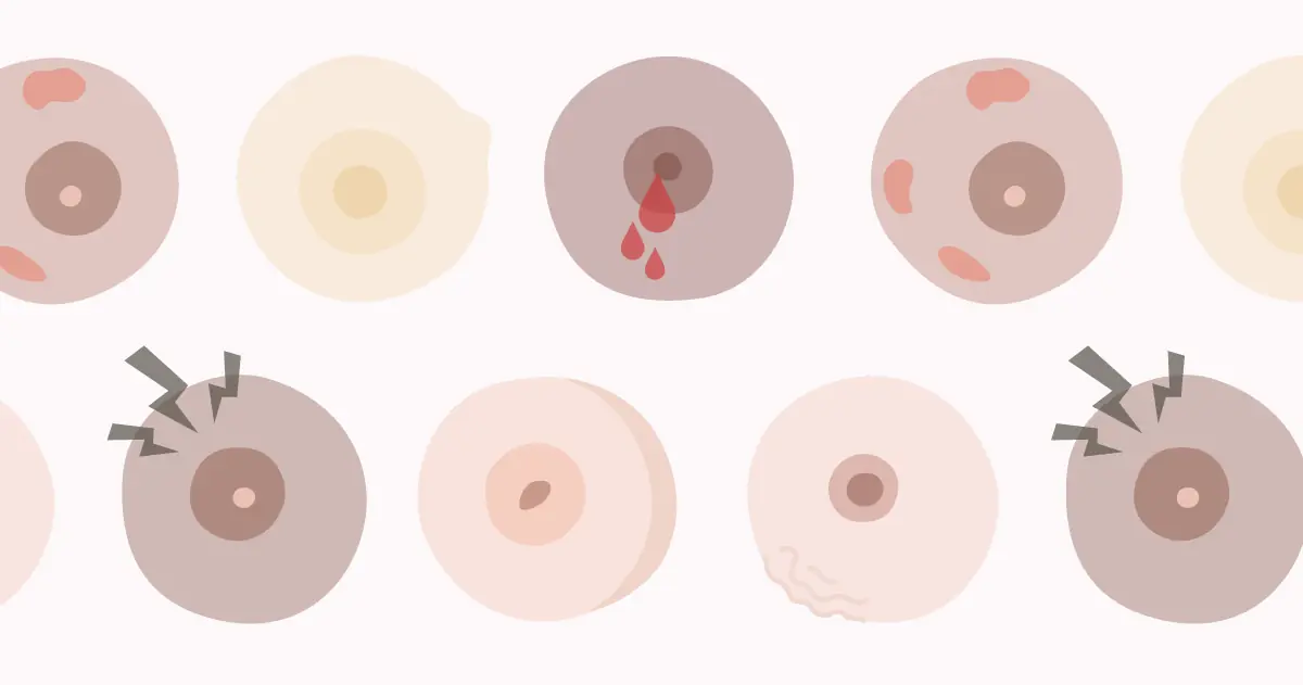 Your Body Could Be Warning You—10 Breast Cancer Symptoms to Know