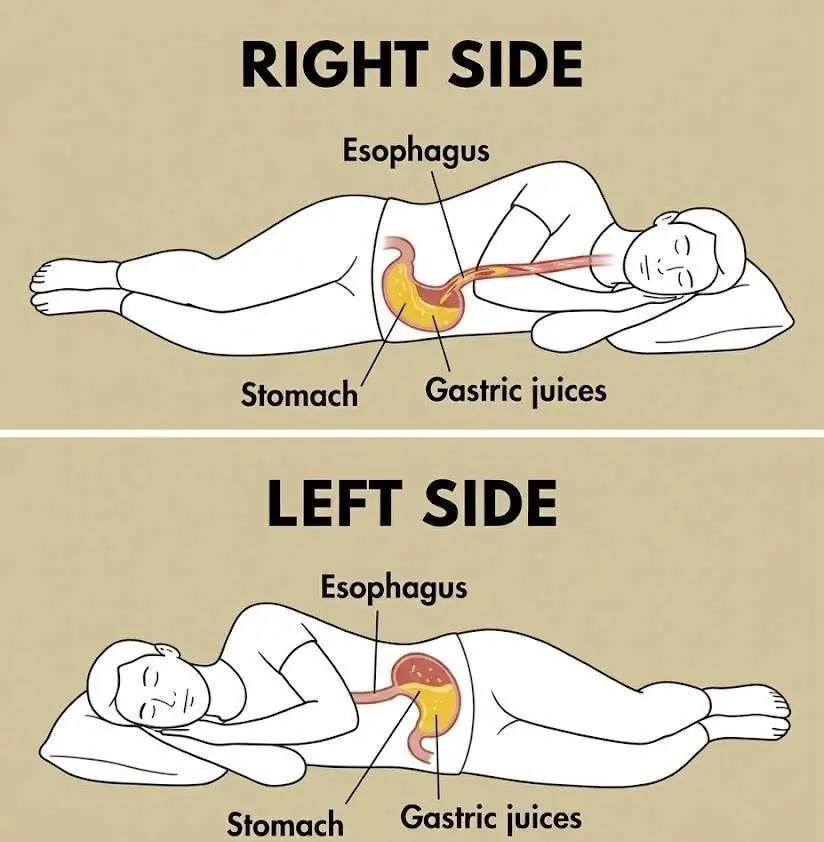 Note that if you always sleep on your right side, you should have... See more