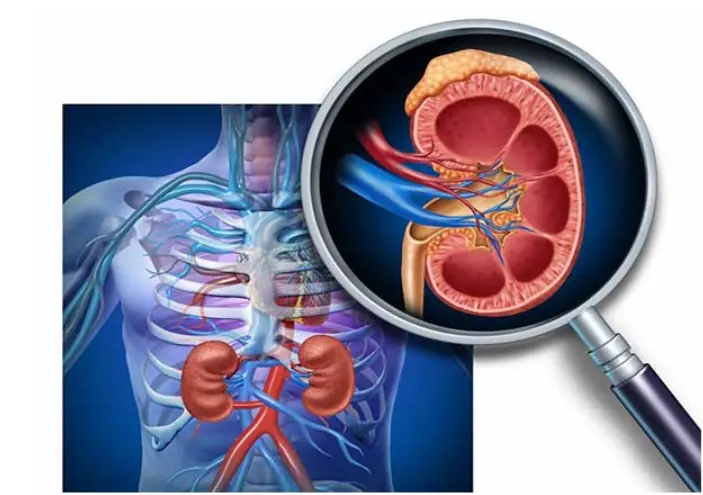 Kidney Disease Doesn't Affect Everyone Equally - Here Are 7 Higher-Risk Groups