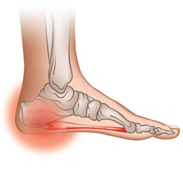 If every morning starts with heel pain, your body may be warning you about an underlying problem