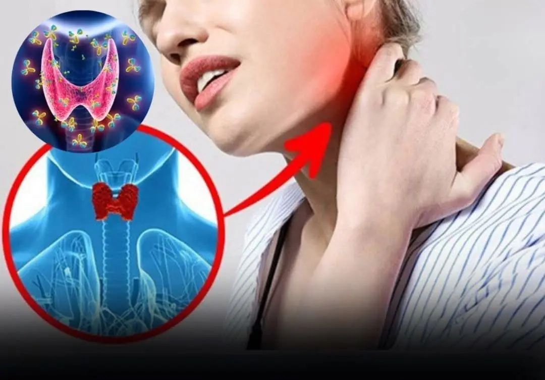 5 Early Signs of Thyroid Cancer That Are Easy to Recognize