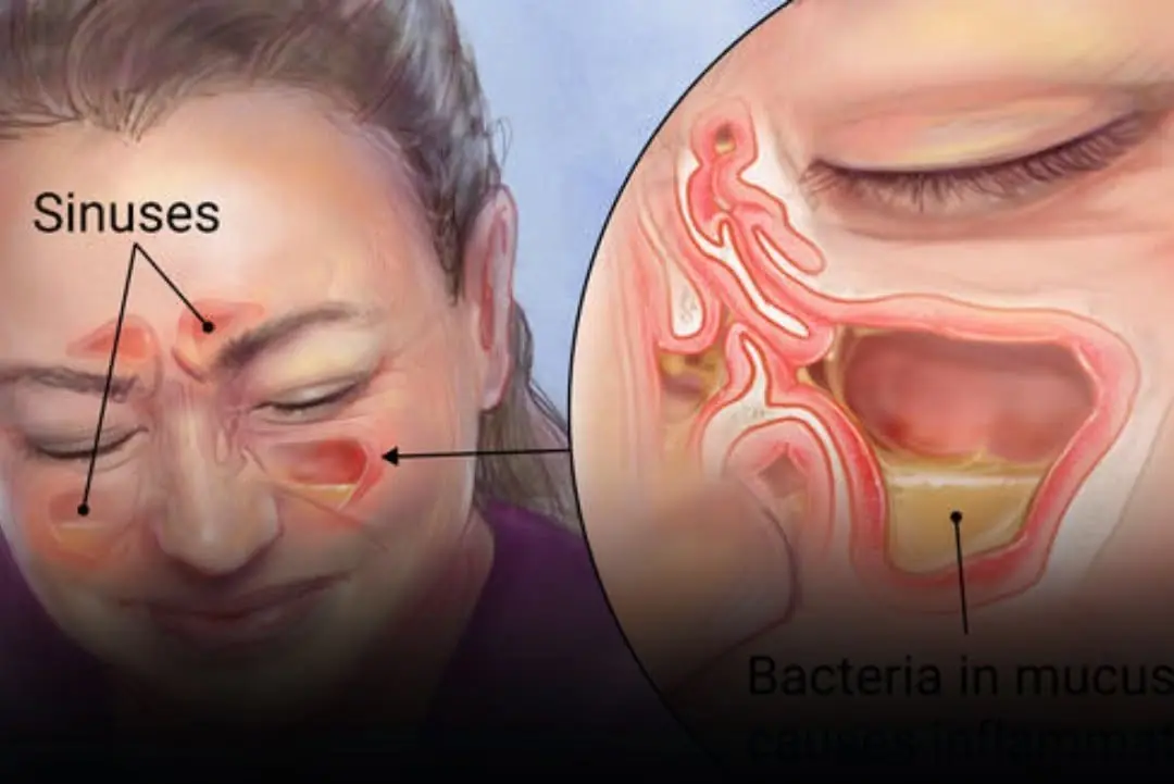 Phlegm doesn’t appear by chance: here’s what your body may be trying to tell you