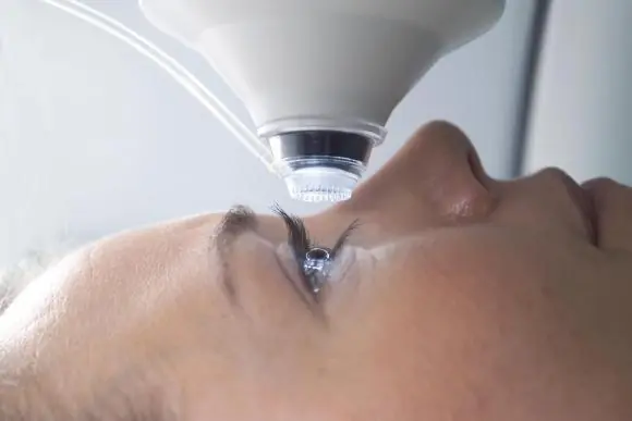 The Dark Side of LASIK: What Every Prospective Patient Should Know Before Surgery