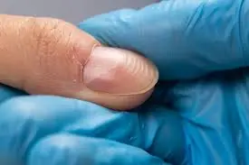 The Lines on Your Nails May Reveal More About Your Health Than You Realize