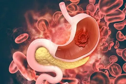 Early Detection Matters: 8 Symptoms That May Signal Can.cer in Older Adults