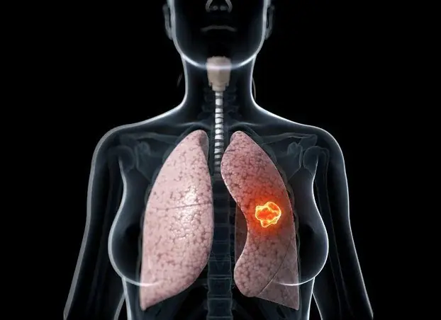 These 3 Persistent Pain Symptoms Could Be Linked to Lung Problems