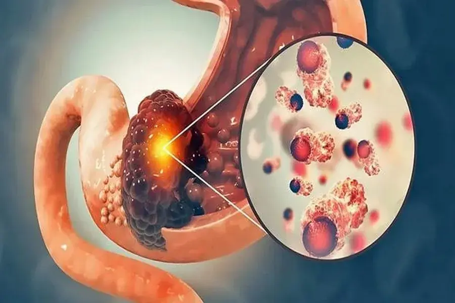 20 Possible Can.cer Warning Signs Everyone Should Know