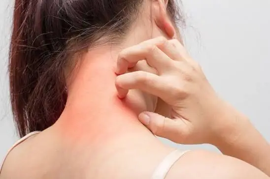 9 Different Types of Itching and What They May Mean for Your Health