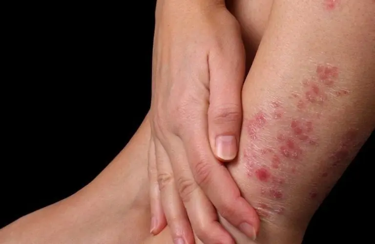 2 Red, 2 Itchy, 2 Unusual Odors - Understanding When It's Time to See a Doctor