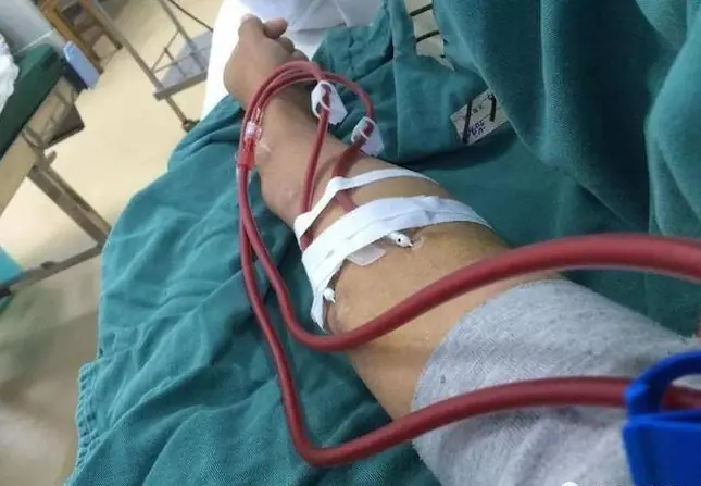 A 52-Year-Old Man Lost Both Kid.neys After Ignoring a Simple Habit Doctors Warned Him About