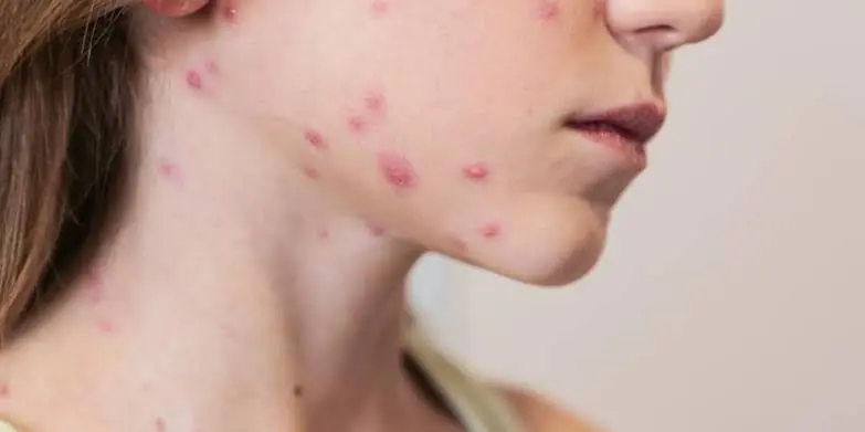 What Causes Red Spots on the Skin? Here Are Some Possible Explanations
