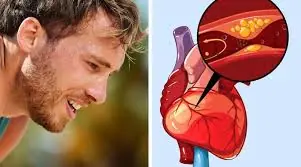 The Best Foods for Healthy Arteries Might Surprise You