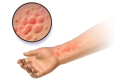 Your Body May Show These 10 Clues Before Kidney Disease Becomes Serious