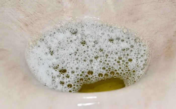 Foamy Urine Isn’t Always Normal — Discover the Possible Reasons