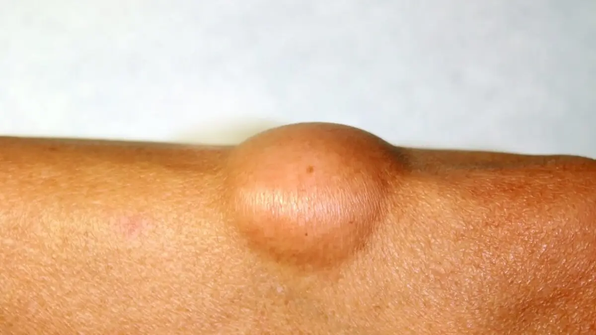 If You Notice a Lump, Don't Panic—Just Don't Ignore These 4 Warning Signs