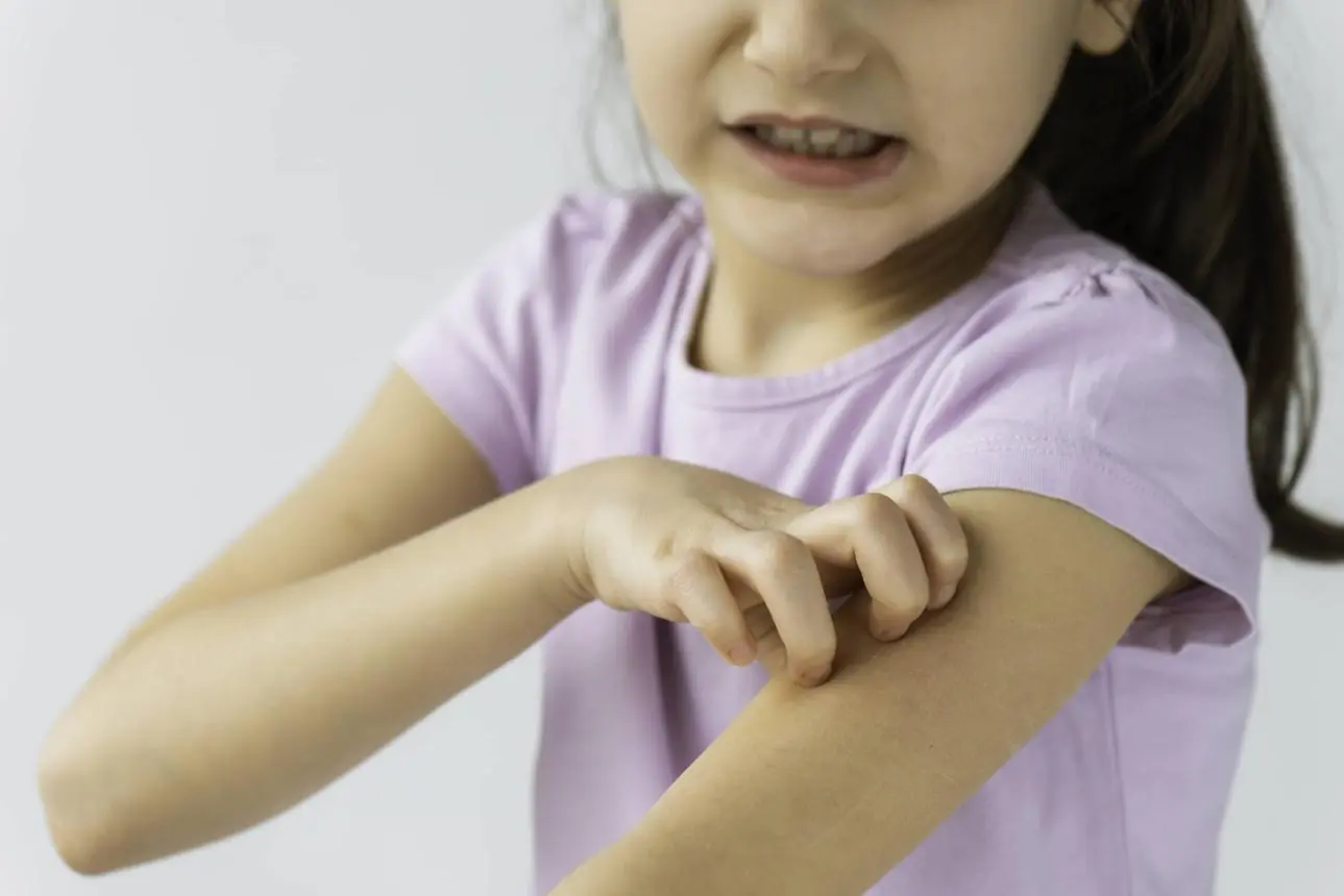 Pinworms: How to Recognize the Symptoms and Stop the Spread