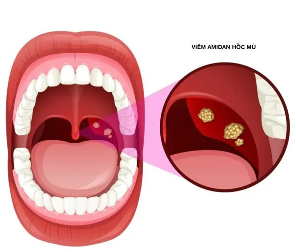 Your Mouth Could Be Sending an Early Warning—Here Are the Symptoms to Watch For