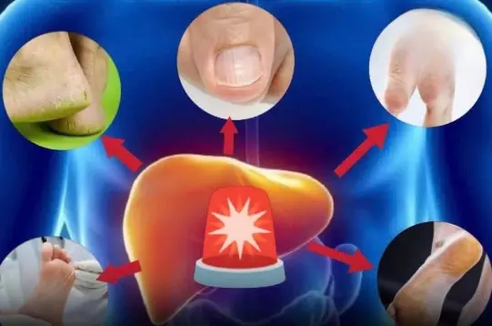 This Symptom in Your Feet Could Mean Fat.ty Liver Dis.ease Can’t Be Reversed