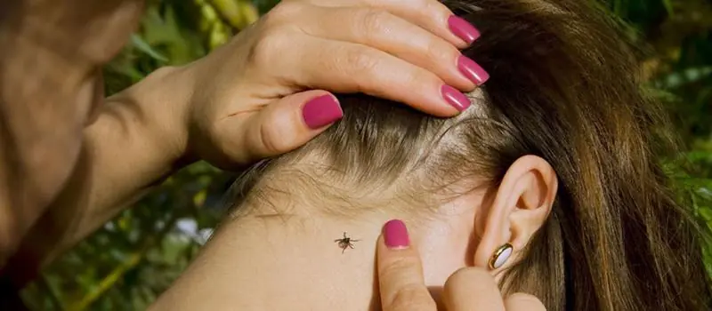What Fell Out of Her Hair During a Shower Turned an Ordinary Night Into Pure Panic