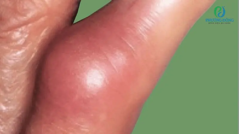 Don't Ignore Swollen Feet and Ankles—These Common Causes May Explain Why