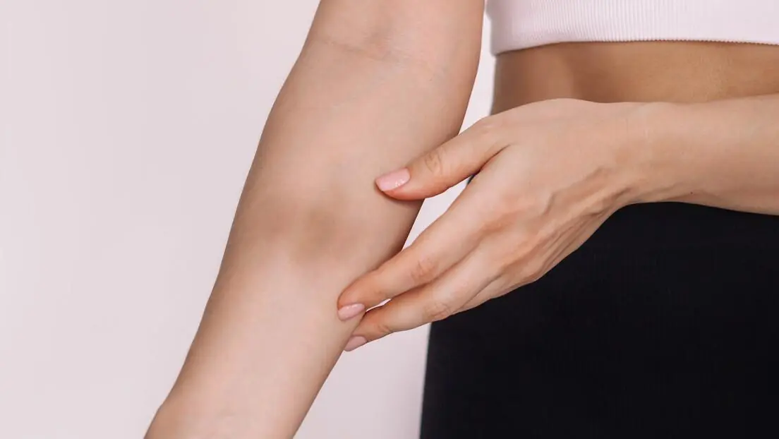 Be Careful: Unexplained Bruises Could Be Your Body's Warning Sign—Here's What They May Mean