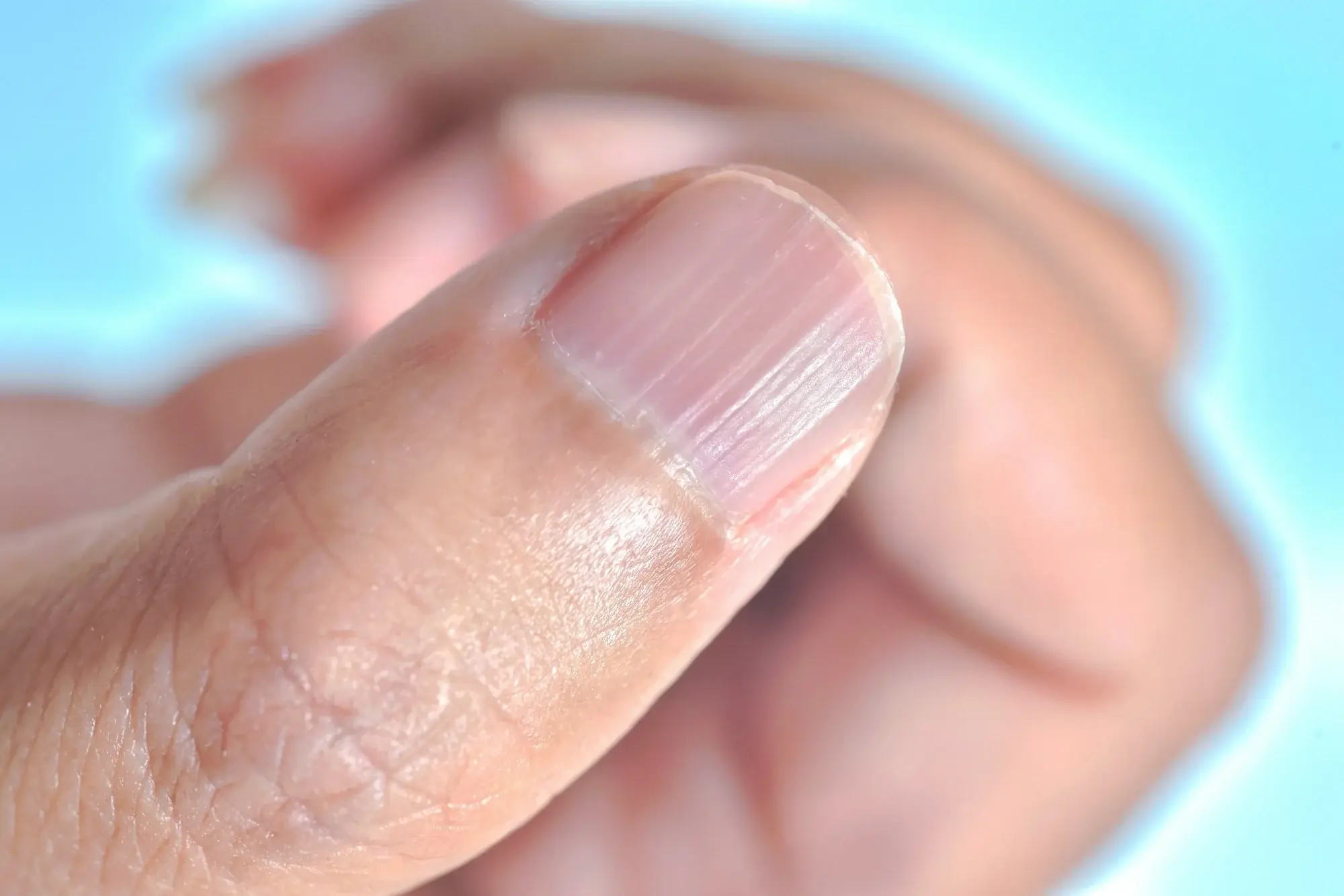 A Nutrition Guide for Healthier Nails: What Your Nails May Be Trying to Tell You