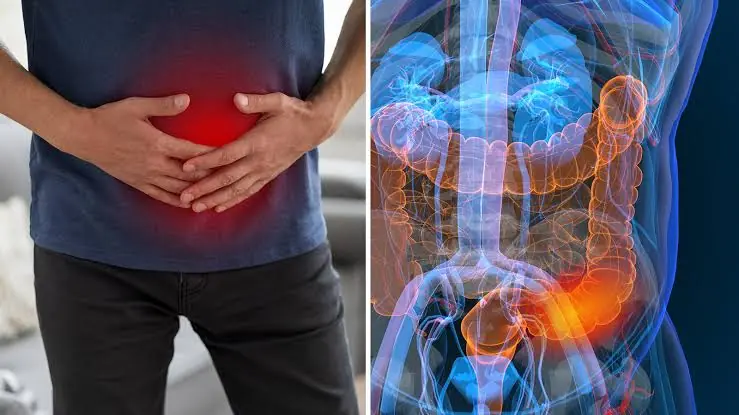 5 Common Symptoms That Could Point to Colon Cancer