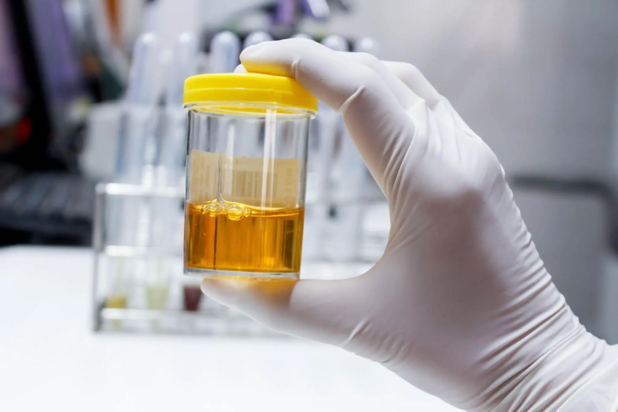 26-Year-Old Ignored Two "Harmless" Symptoms—Doctors Said He Would Need Dialysis for Life