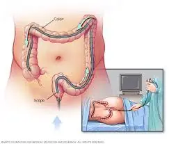 Your Doctor Suggested a Colonoscopy? Here's What You Should Know Beforehand.