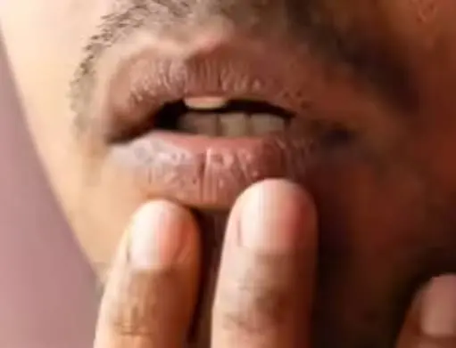 Why Is Your Mouth So Dry Every Morning? Here Are 8 Possible Explanations