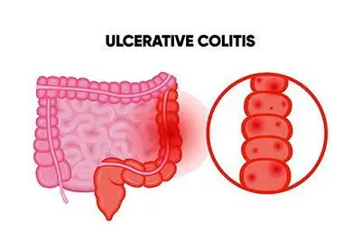 Could These 20 Common Symptoms Be Something More Serious?