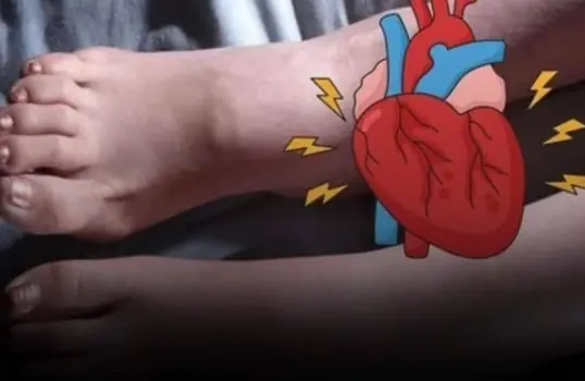 One Month Before a Heart Attack, Your Feet May Warn You With These 6 Signs