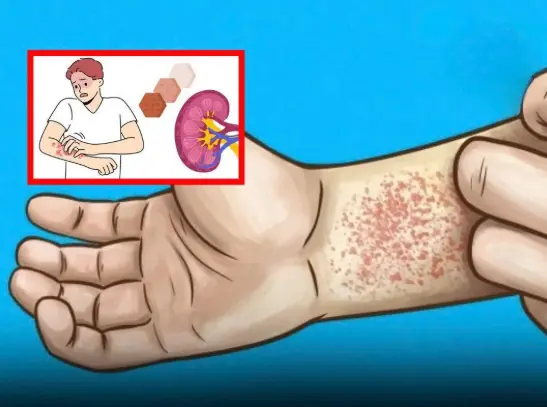 10 Ways Your Body Warns You About Kidney Disease (But You Don’t Notice)