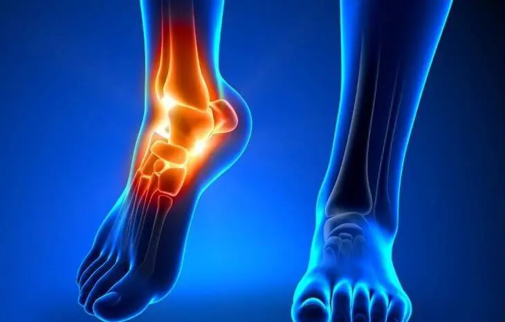 Your Heel Hurts First Thing in the Morning? Here's What May Be Causing It