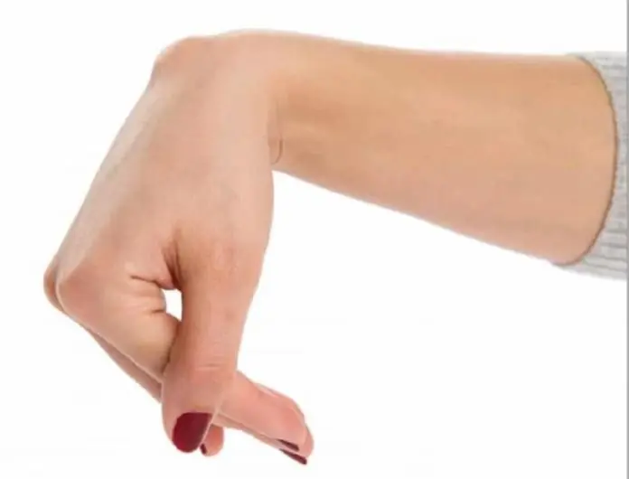 A Wrist Bump Could Have Several Causes—Here's What to Know