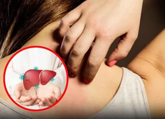 4 Skin Symptoms That Could Be Warning Signs of Liver Disease