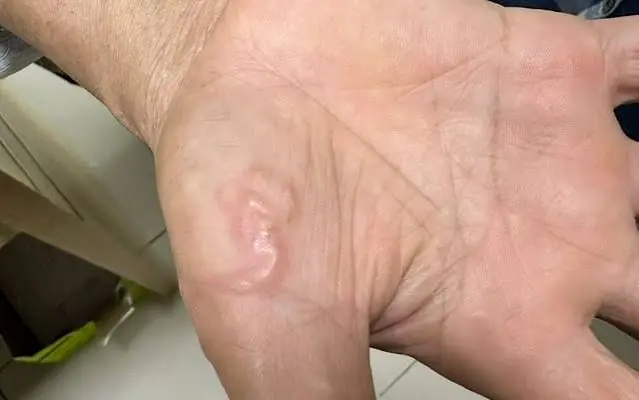 Doctors Say These 4 Common Foods Deserve Extra Caution Due to Parasite Risk